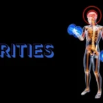 Attrities: Meaning, Importance, and Real-Life Examples