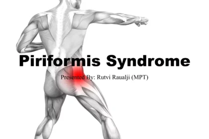 How to Manage pririformus syndrome pdf Effectively